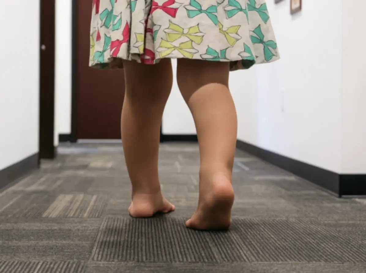 Child demonstrating pigeon-toed gait while walking in a pediatric foot and ankle clinic hallway, showing signs of intoeing.