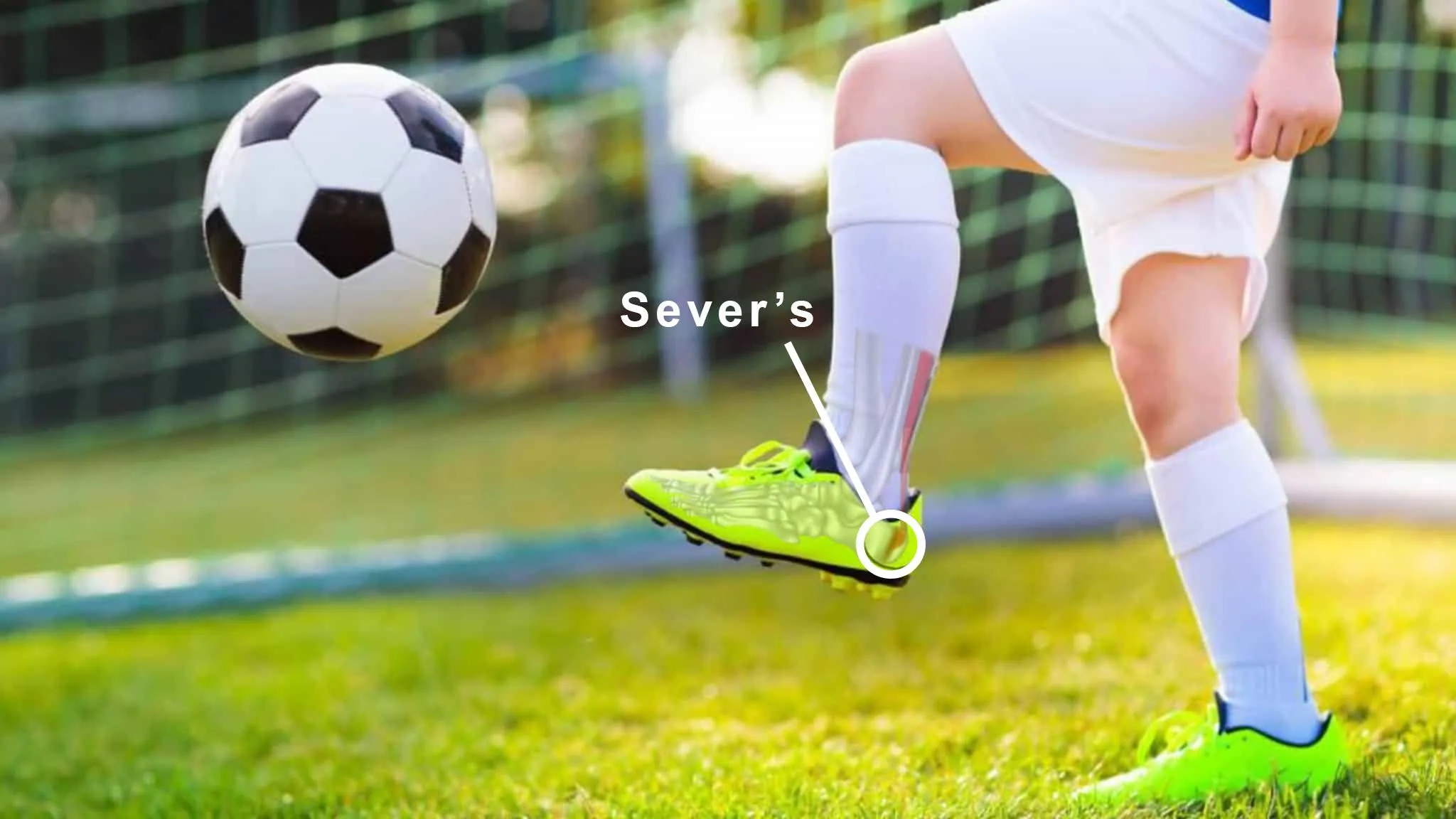 Child with Severs Disease heel pain during sports activity - pediatric heel condition treated at Pediatric Foot and Ankle Chandler AZ