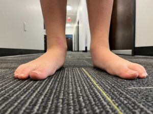 Barefoot Season: Is It Safe for Kids?
