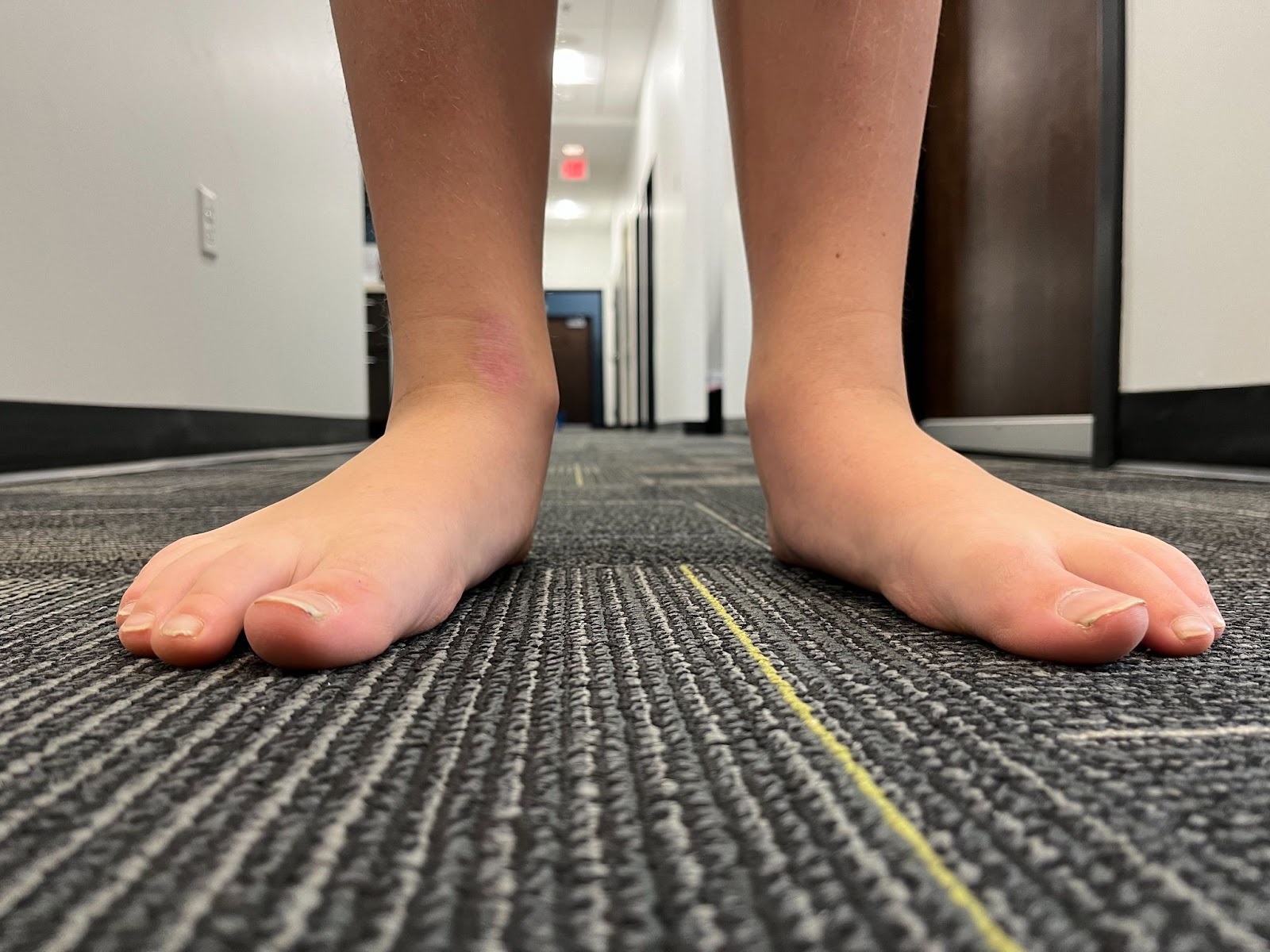 Barefoot Season: Is It Safe for Kids?