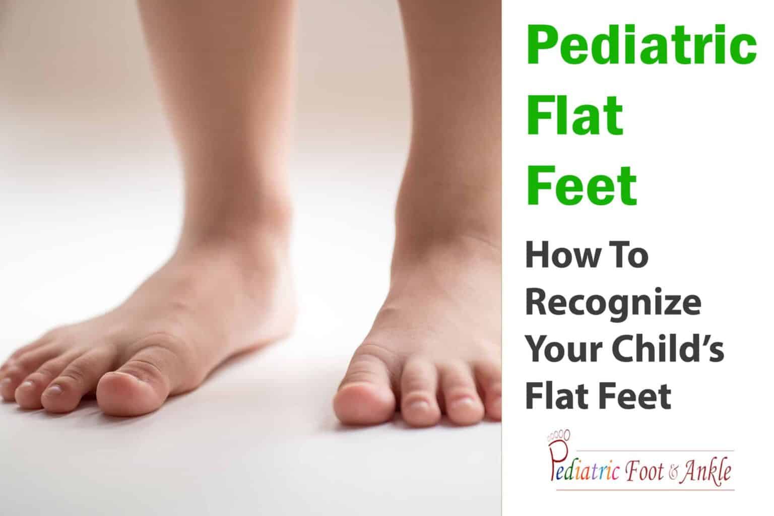 How to Recognize Flat Feet in Children Pediatric Foot & Ankle