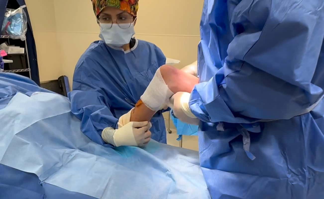 Toebro Virtual Consultations for Toe Walking with Dr. Jarman - Pediatric Foot ...
